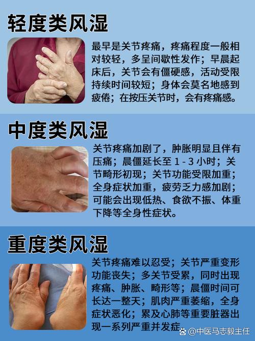 类风湿关节炎是怎么回事