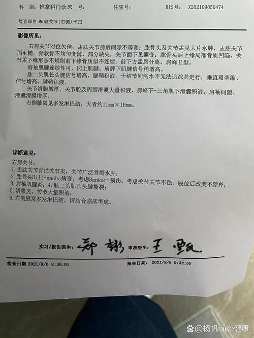 风湿性关节炎的诊断标准