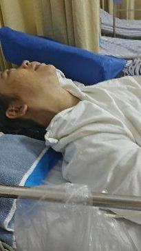 脑梗 左侧胳膊不能动