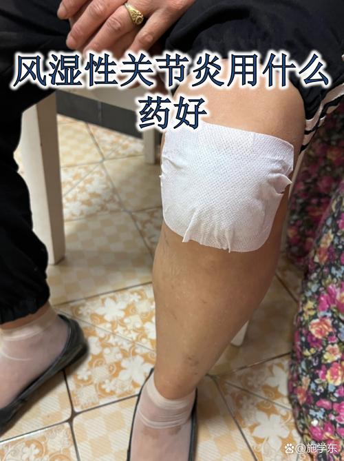 风湿治疗德胜门 领先