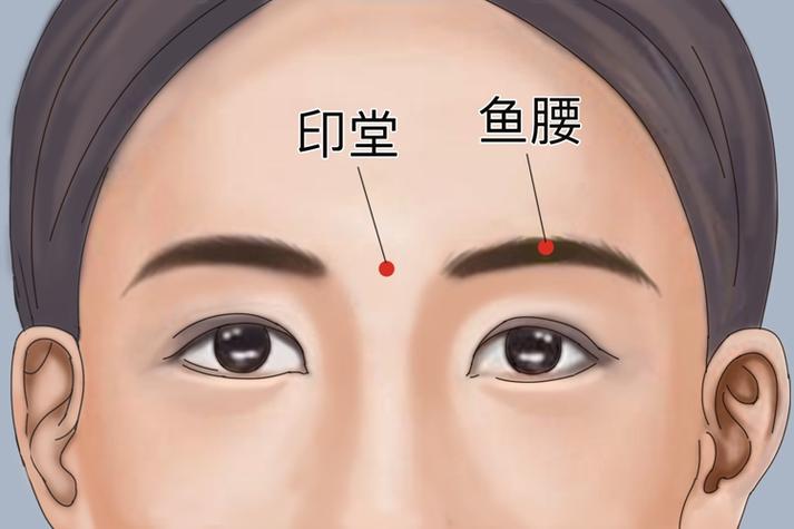 印堂 神庭 鱼腰穴位