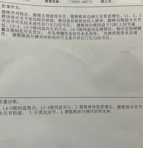 检查没风湿 腿疼