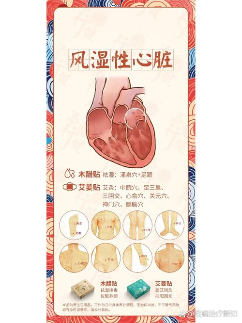 风湿心脏病一定风湿热