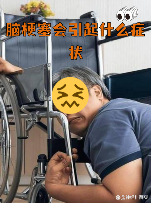 脑梗 左边胳膊腿麻木