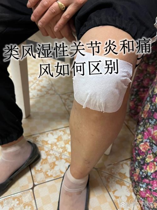 类风湿因子27.77