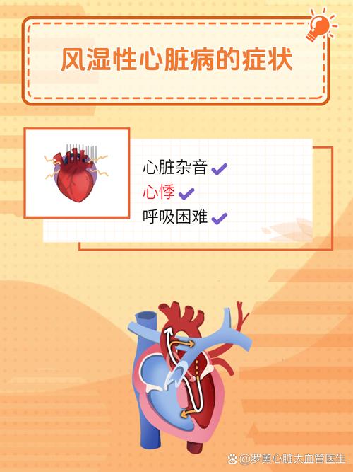 风湿性心风湿性心脏病