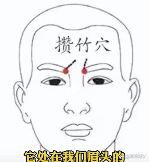 穴位图-攒竹穴