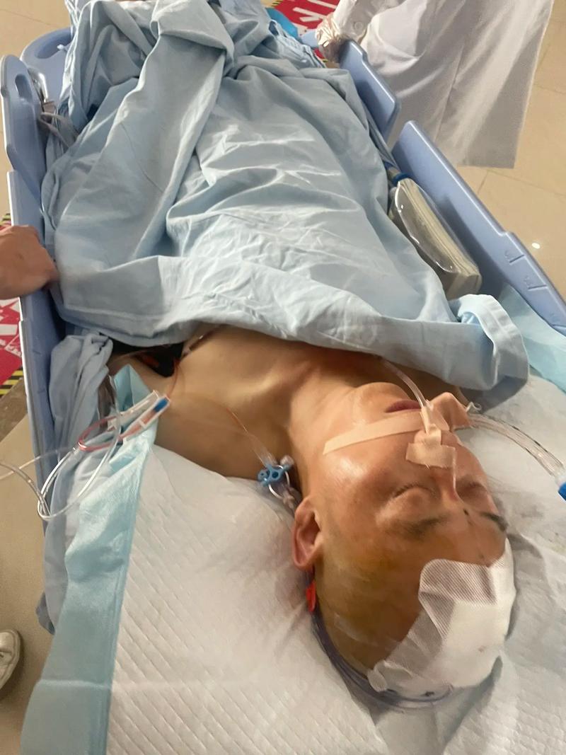 红斑狼疮 脑梗 昏迷