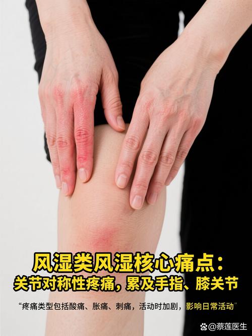风湿及类风湿膝关节痛