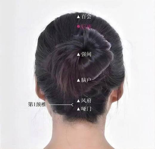 头顶后顶穴位(失眠)