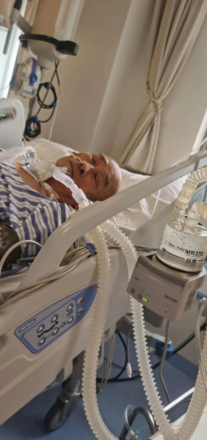 脑梗病人苏醒后又昏迷