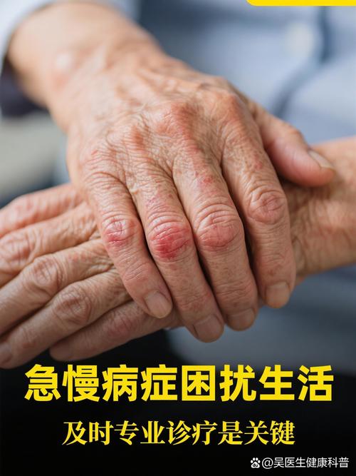 轻微脑梗患者突然手软