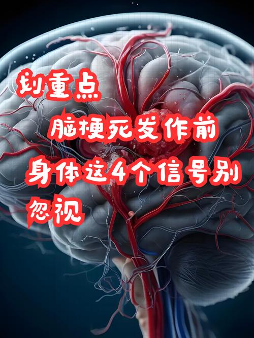 脑梗 神志不清 语言