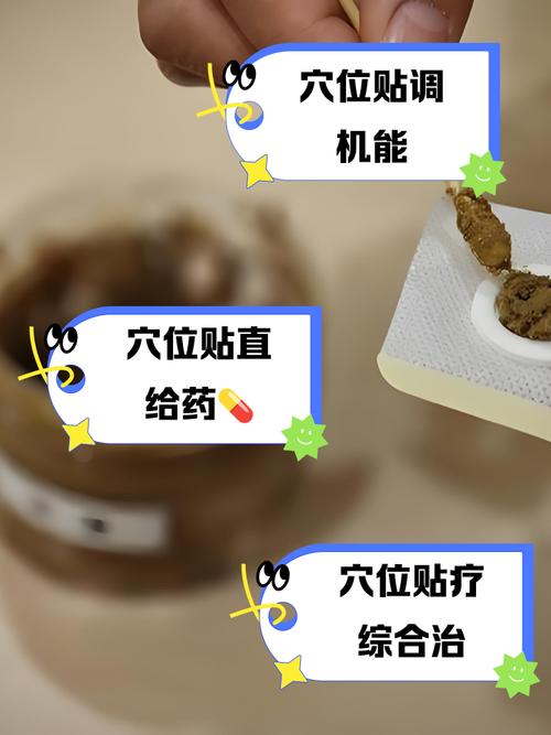 穴位贴不贴穴位可以不