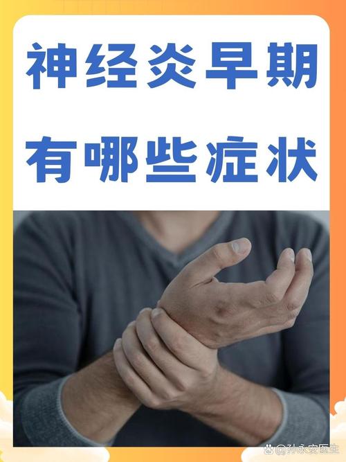 风湿性神经炎是风湿吗