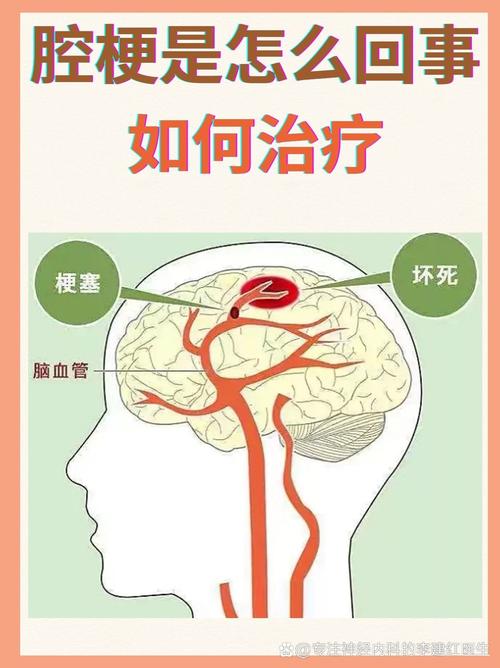 脑梗和呛梗有什么区别