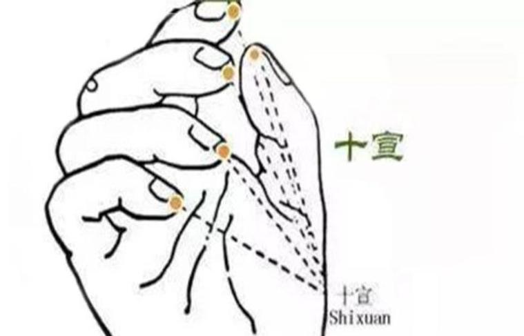 穴位十十宣穴位位置图