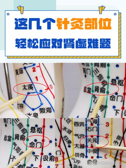 针灸穴位腰痛穴位名称