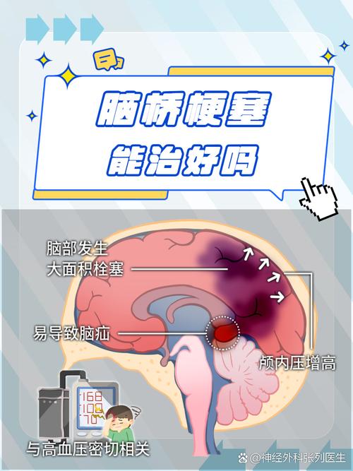 脑桥及左侧基底节脑梗