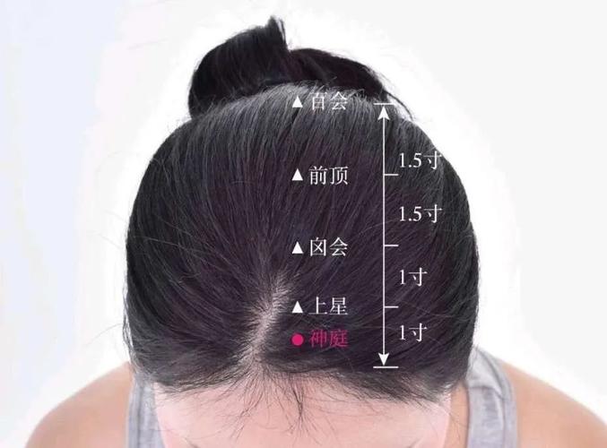 头顶心穴位叫什么穴位