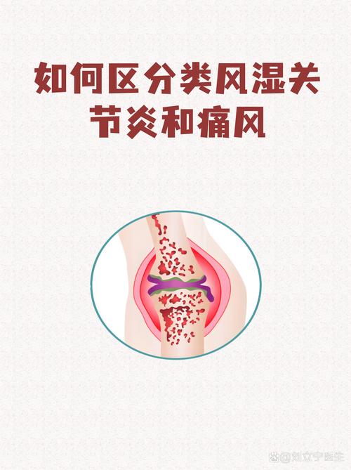 风湿病和类风湿的关系
