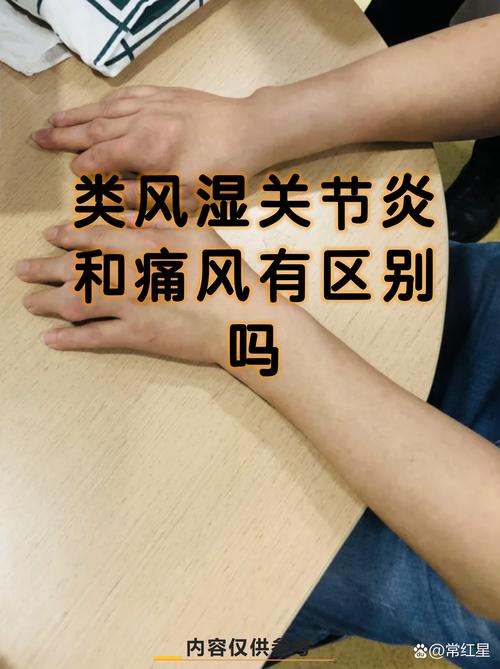 风湿病和类风湿的关系