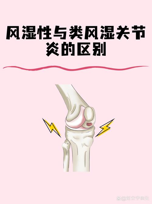 风湿能转换成类风湿吗