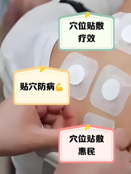 小儿感冒穴位贴敷穴位