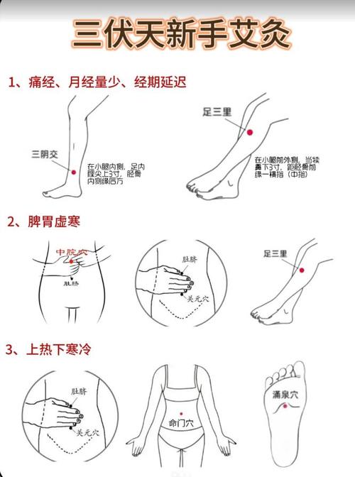 三伏天艾灸的重要穴位