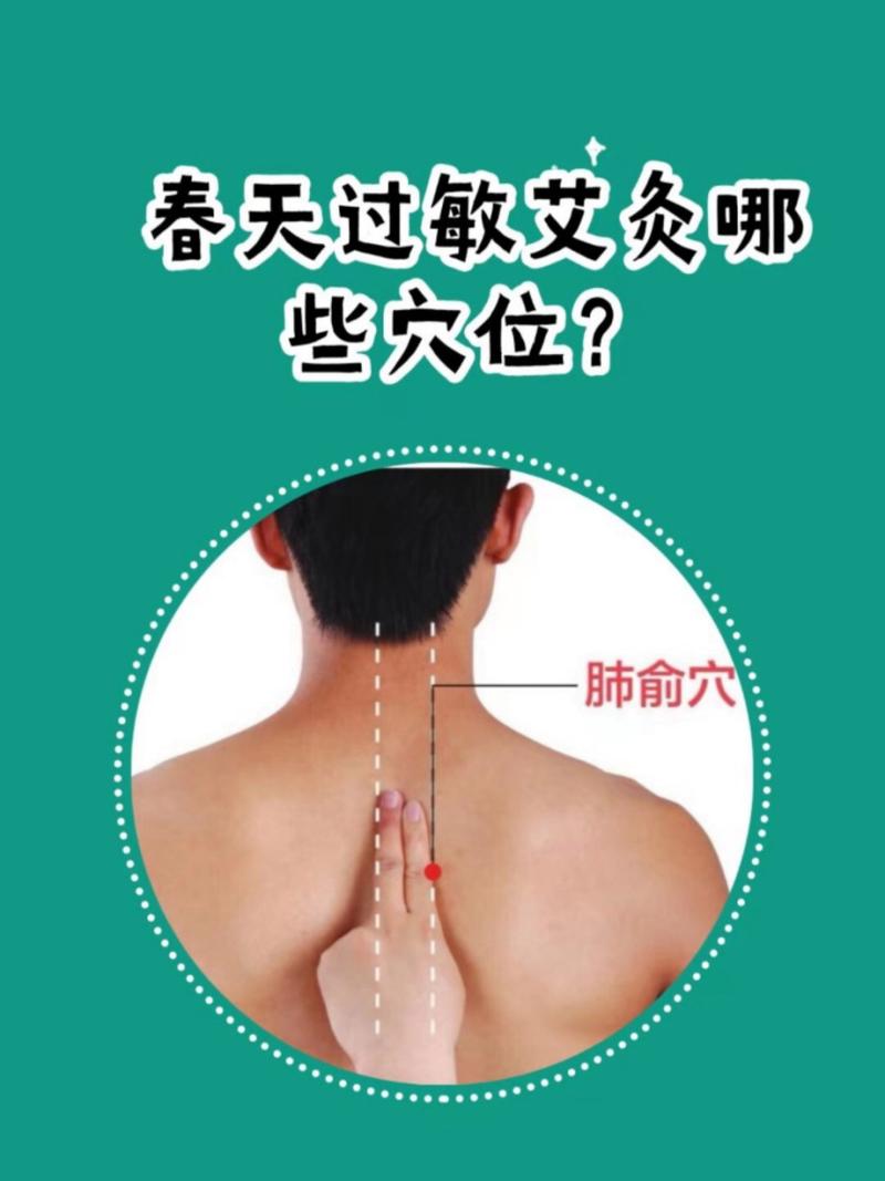 皮肤过敏艾灸什么穴位