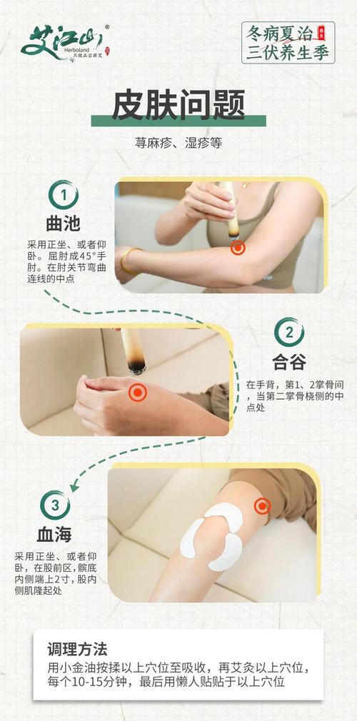 皮肤过敏艾灸什么穴位