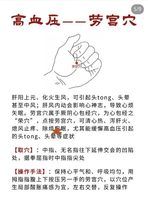 心动过缓穴位治疗方法