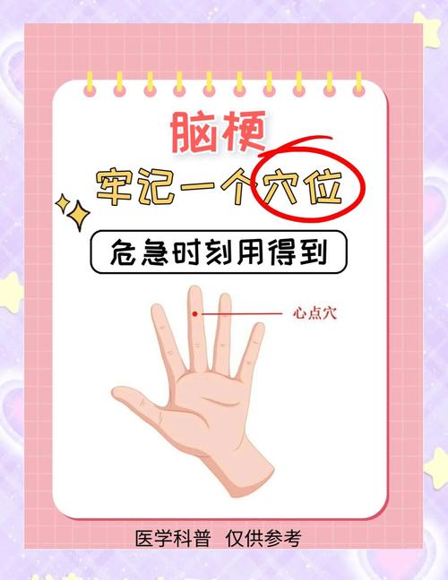 心动过缓穴位治疗方法