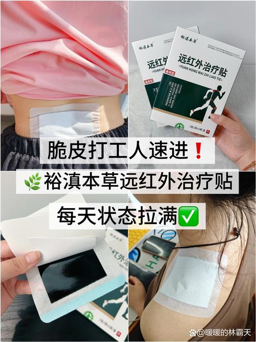 风湿拔罐还是贴风湿膏