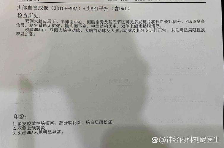 做脑c七能查出脑梗吗