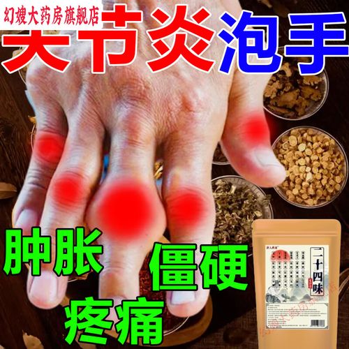 类风湿风湿用什么药泡