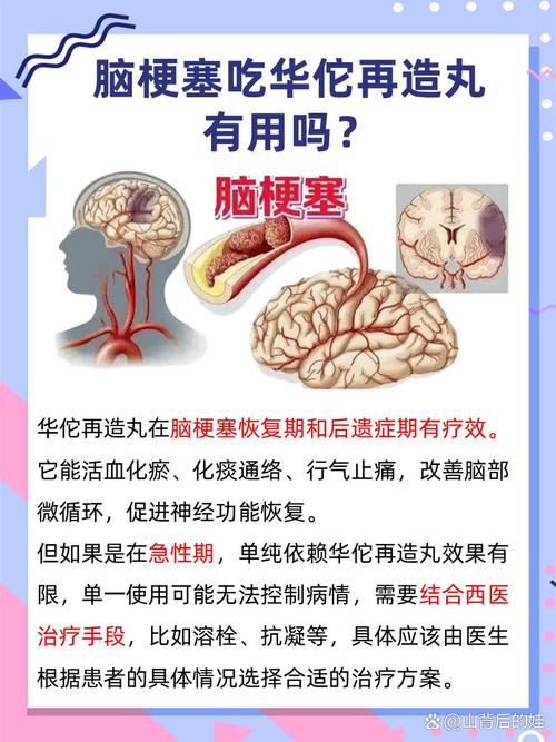 脑梗可以吃脑得生丸吗