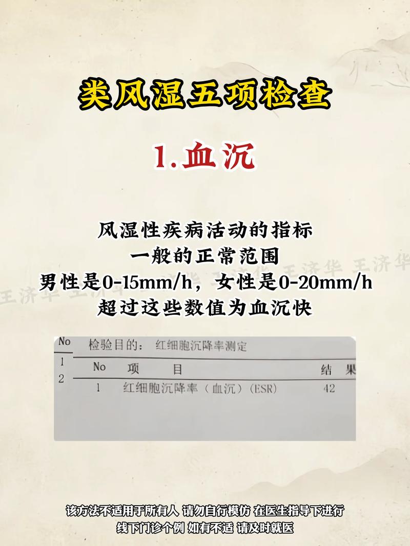 得了风湿风湿五项正常