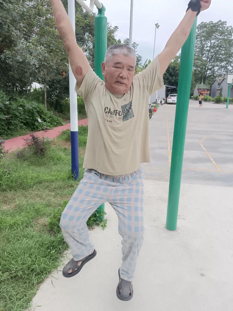 脑梗吃脑复康治疗效果