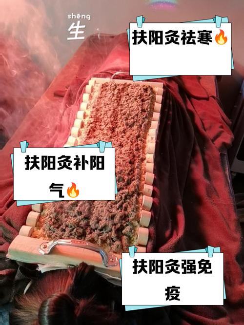 风湿类风湿艾灸有用吗