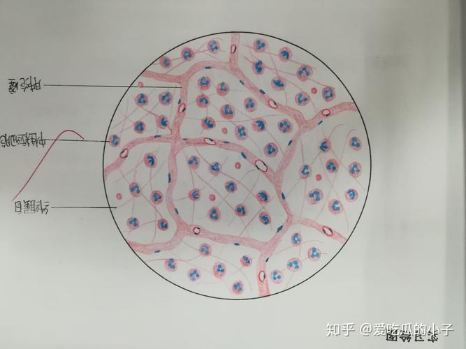 风湿巨细胞与风湿小体