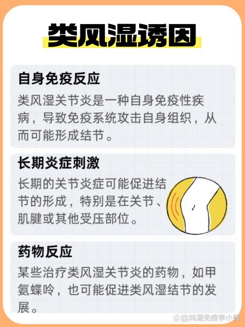 风湿类风湿晨僵的区别