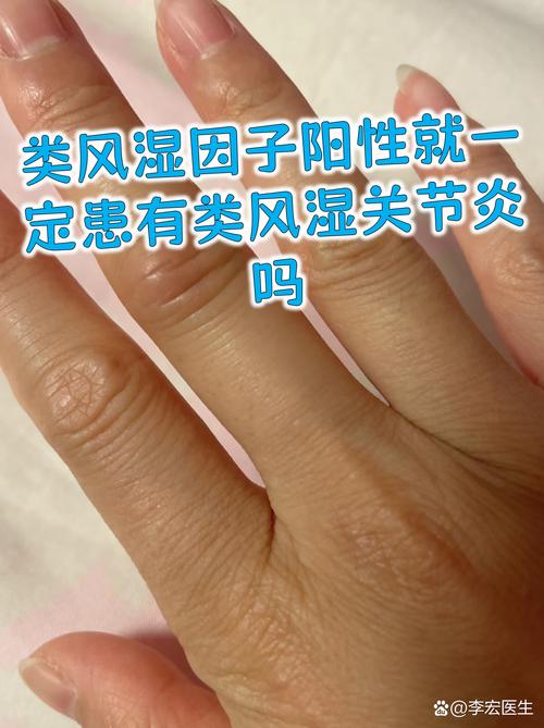 风湿性肺炎没有风湿呀