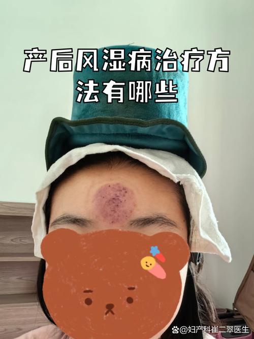 风湿膏能治产后风湿吗