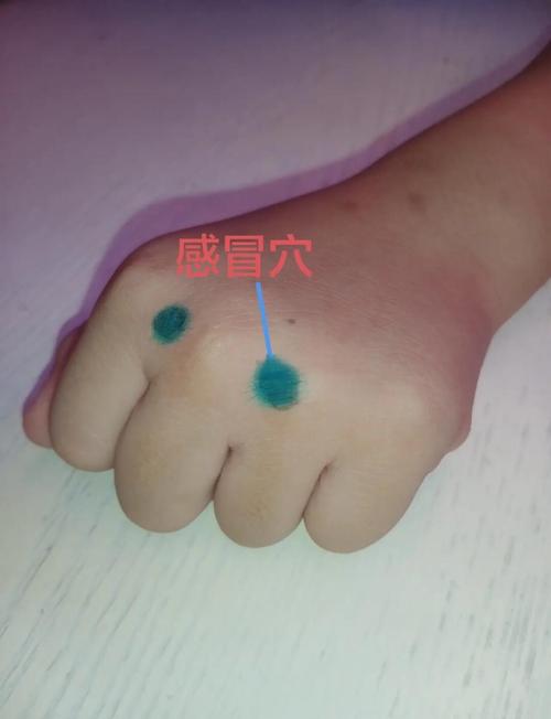 发烧可以按摩什么穴位