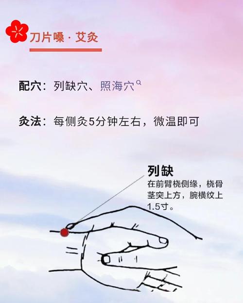 慢性咽炎艾灸什么穴位