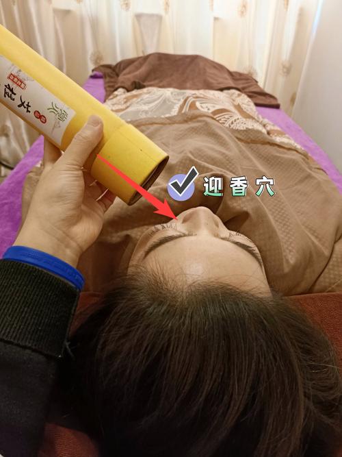 三伏贴过敏性鼻炎穴位