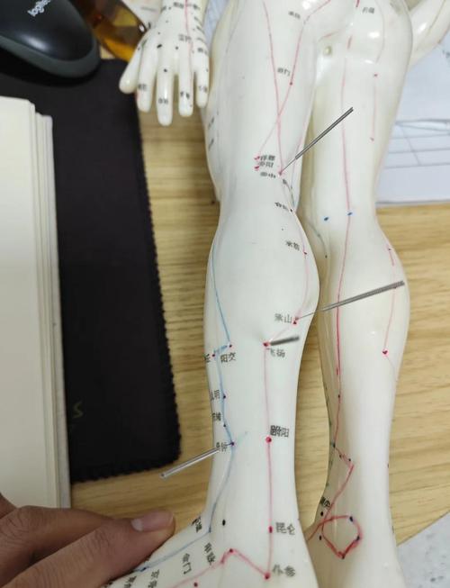 坐骨神经痛穴位按摩图