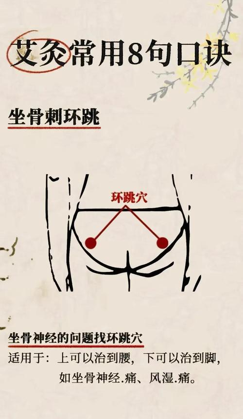 坐骨神经痛艾灸穴位图