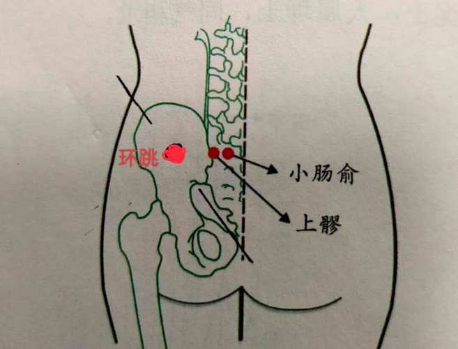坐骨神经痛艾灸穴位图